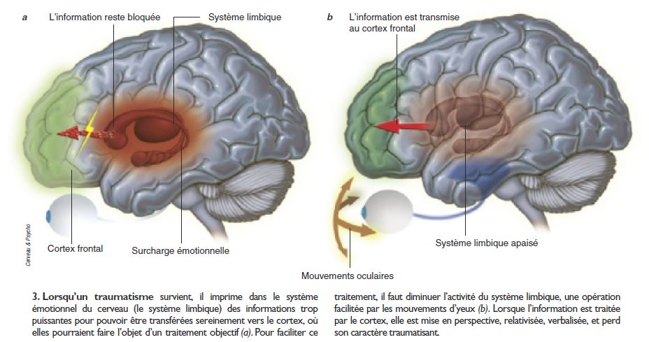 Emdr - Principes neurophysiologiques